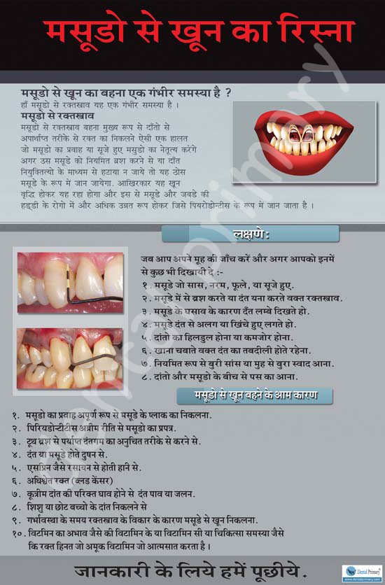 Hindi Posters Dental Primary