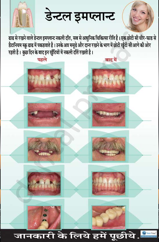 DP 90 Dental Primary